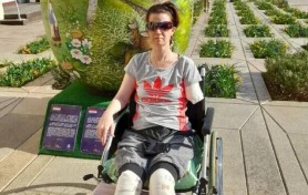 O femeie a rămas fără o mână şi ambele picioare, la 11 zile după ce a mers la spital pentru dureri de burtă